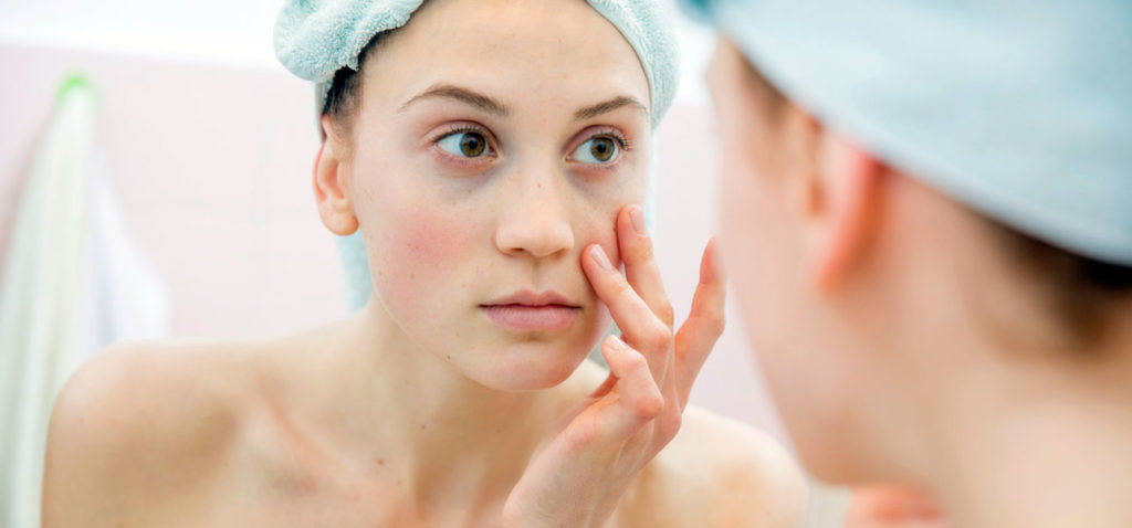 4 Ready Home Remedies to Remove Dark Circles