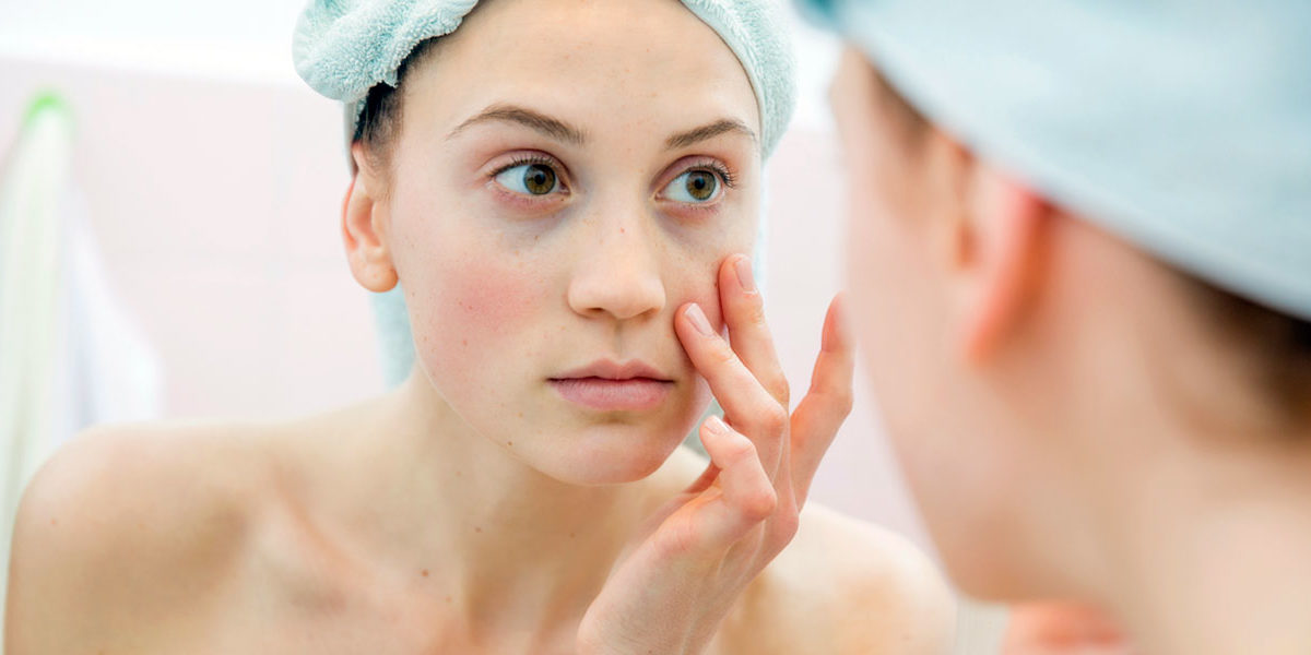 4 Ready Home Remedies to Remove Dark Circles