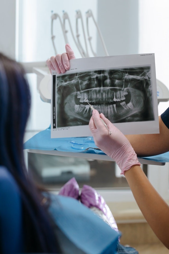 Causes and Treatments for Misaligned Teeth