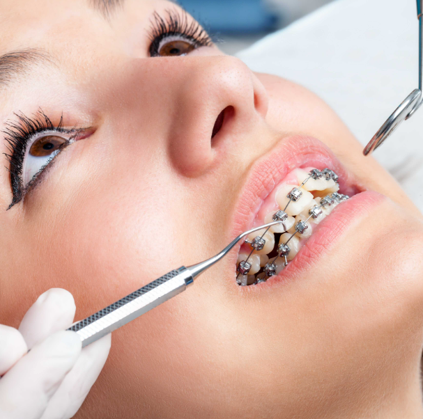 Aligners and braces can work wonders for you to let your overbite become a thing of the past